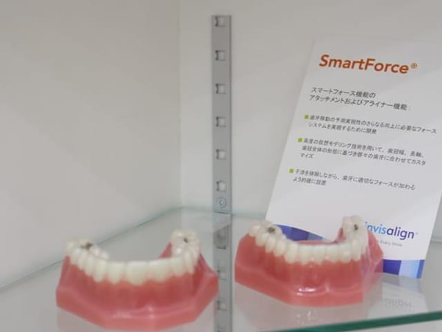 invisalign